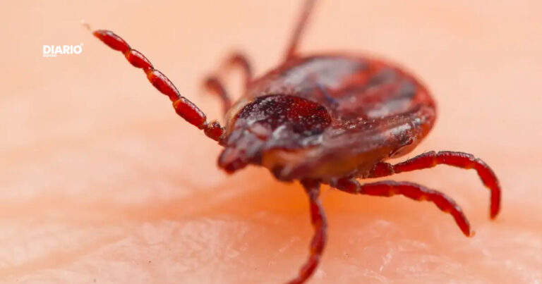 Cresce o número de casos de febre maculosa em São Paulo